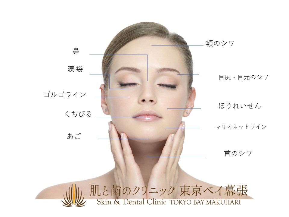 ヒアルロン酸